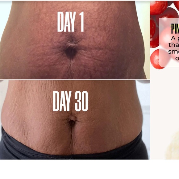 COPY - MAELYS B-FLAT BELLY FIRMING CREAM 100ML - Picture 4 of 11